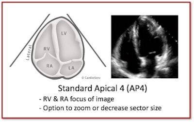 Standard Apical 4 (AP4)