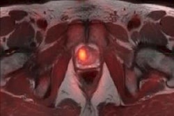 2017 08 07 11 35 26 566 2017 08 07 C 11 Sarcosine Pet 20170807183658