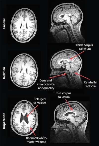 2017 08 07 13 57 56 485 2017 08 08 Mri Autism