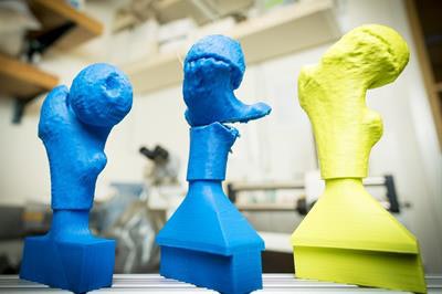 UCSD surgeons found that 3D printing can shorten surgical fluoroscopy time in pediatric hip surgeries. Image courtesy of UCSD.