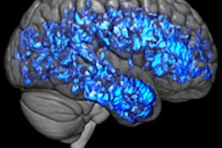 2017 08 14 14 16 50 147 Pet Serotonin Johns Hopkins 200
