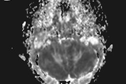 2017 08 14 16 11 12 693 Mri Baby Ketamine 20170814231155