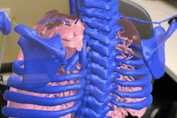 2017 08 15 13 17 42 123 Lung Model Courtier 400