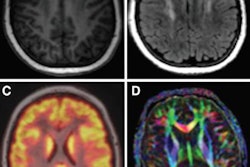 2017 08 22 16 21 32 632 Brain Mri Pedx Images 20170822232215