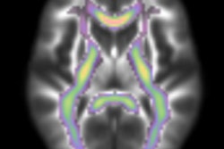 2017 08 24 10 04 41 695 Mri Brain Fa Churchill 400