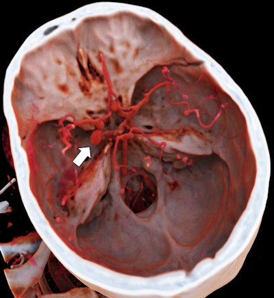 2017 08 24 15 02 38 681 2017 08 25 Cinematic1