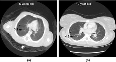 The effect of reconstruction field-of-view size on the displayed diameter of a nodule. Image courtesy of Samei et al.