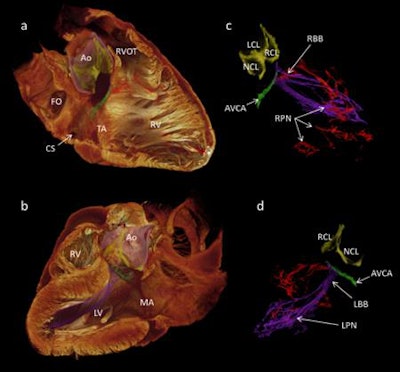3D visualization of the cardiac conduction system of a healthy human heart, generated via 3D reconstruction of micro-CT image data. Image courtesy of Aarhus University.