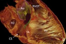 2017 09 13 15 43 2219 2017 09 12 Cardiac Conduction 400