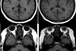 2017 09 18 17 10 0965 Macro Gbca Am Mri Insider 20170918173053