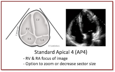 All images courtesy of CardioServ.