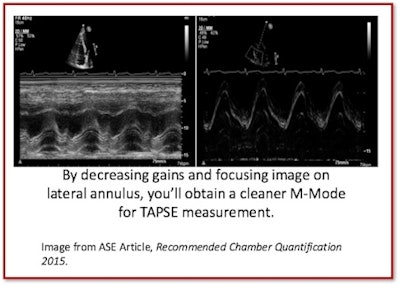 Obtain cleaner M-mode for TAPSE