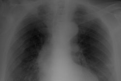 2017 09 18 23 35 5494 Rosenkratz Tech Repeat Xray 400