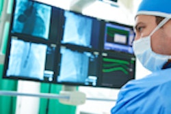 2017 09 19 23 06 5294 Cadiologist Ibm Watson 150