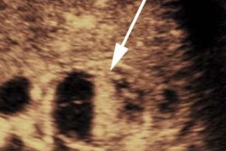 2017 09 20 16 59 4633 Jum Zarzour Renal 20170920163548