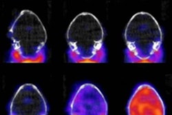 2017 09 21 17 20 3990 Pet Zika Mouse Brains 20170921171140