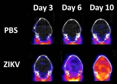 Representative DPA-714-PET images (bottom row) of mouse brain at third, sixth, and 10th day after infection with Zika virus. Red area indicates neuroinflammation. Top row shows control images for comparison. Image courtesy of USAMRIID.
