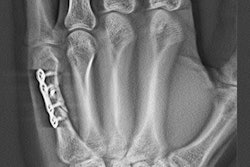 2017 09 21 23 20 1264 Frauenfelder Dts Hand 20170921230829