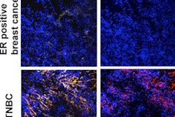 2017 09 25 23 38 7443 Mr Gado Breast 20170925231318