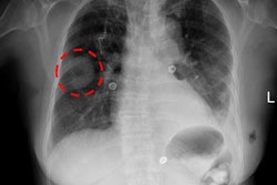 2017 09 28 16 05 8299 Nih Database X Ray 20170928164634