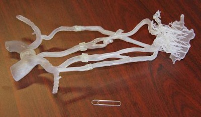 A 3D-printed brain perfusion phantom allows interventionists to practice mechanical thrombectomy procedures. All images courtesy of David Brotman and Dr. Clifford Yang.