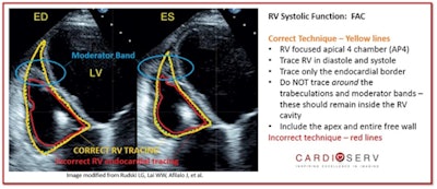 All images courtesy of CardioServ.