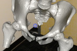 2017 10 11 23 27 0877 Augmented Radiology 1 20171011232513