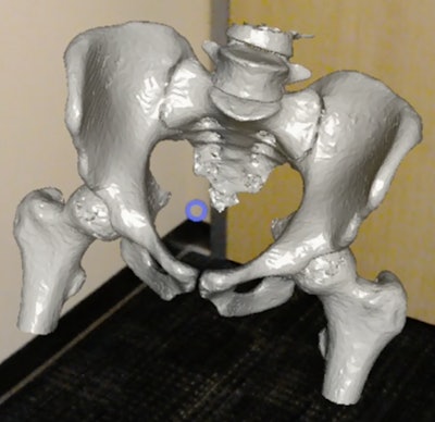 The RadHA app uses Microsoft's HoloLens virtual reality technology to display 3D CT images, overlaid on a real-world background.