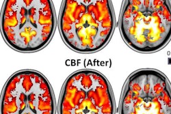 2017 10 13 18 31 3321 Brain Mri Mushrooms 20171013185650