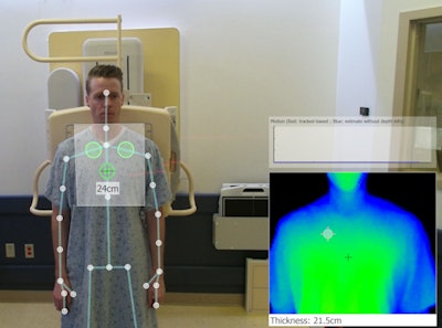 The X-Vue user interface displays an overlay of the three active exposure chambers (green circles) within the detector field (white box) on top of the patient. A depth map (bottom right) displays the body part thickness. A motion trace using skeleton tracking and optical flow sits above the depth map. Image courtesy of Robert MacDougall.