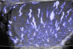 2017 10 23 16 59 3361 2017 10 13 18 47 9892 Philips Ultrasound 400