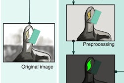 2017 10 23 19 00 1492 2017 10 24 3 D Woundprint Framework Thumb