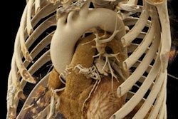 2017 10 24 21 57 6251 Best Radiology Image 400