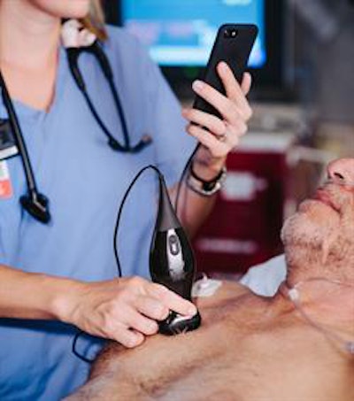 Image courtesy of Butterfly Network.