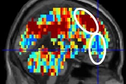 2017 10 31 00 44 1529 Suicide Mri 400