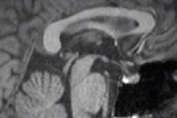 2017 11 01 17 58 7784 Roberts Mri Video 400