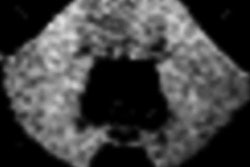 2017 11 13 21 40 7325 Patient 21 Gbca Mri 20171113210712