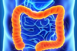2017 11 15 21 16 4926 Colon Intestine 400