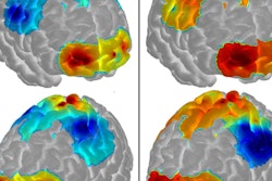 2017 11 17 21 09 4541 F Nirs Brain Map 400