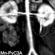 2017 11 17 22 49 0030 Magnesium Mri Contrast Agent 20171117225819