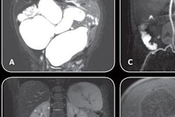 2017 11 20 21 13 5718 Air Coil Pediatric Images 20171120214855