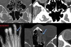 2017 11 22 00 09 5237 Domestic Violence 20171122003432