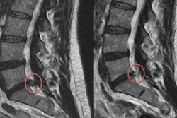 2017 11 23 01 14 6440 Rsna Back Pain 2017 11 29 20171123010333