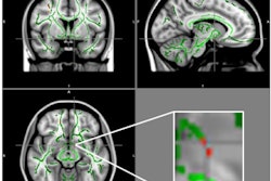 2017 11 27 01 40 6884 Brain Appetite Regulator 400