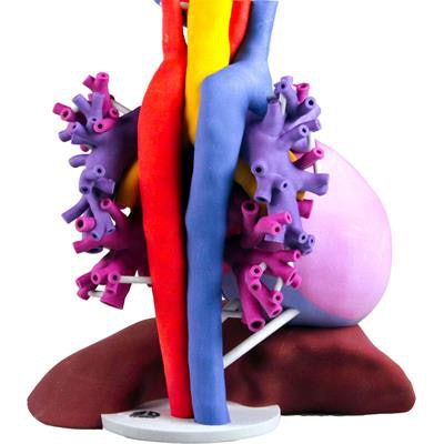 3D Systems' patient-specific anatomical model takes 2D medical imaging data to 3D for improved visualization using the ProJet CJP 660Pro 3D printer. Image courtesy of Philips Healthcare.