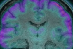 2017 11 27 21 20 8189 Rsna Sse16 06 Kwan Mr Images 400