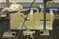 2017 11 27 22 09 8990 3 D Coronary 20171127222038