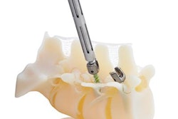 2017 11 27 22 23 6593 Stratasys 3 D Spine Model 20171127223242