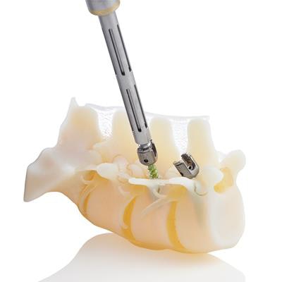 True-to-life anatomical structures: A pedicle screw driven into a 3D-printed model of a patient's spine. Image courtesy of Stratasys.