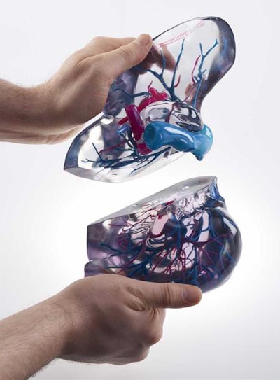 Philips announced new alliances in 3D printing at RSNA 2017.